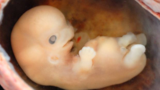 Lidské embryo, stáří 6 až 7 týdnů