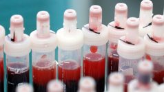 Vzorky krve připravené k testování na přítomnost koronaviru