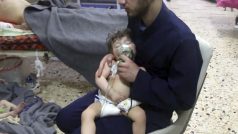 Snímek na kterém je podle organizace Bílé helmy a agnetury AP jedno z dětí zasažených chemickým útokem v Dúmě.