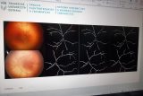 AI může pomoci s podchycením nemocí. Retinopatii může odhalit a léčit i u nedonošených dětí