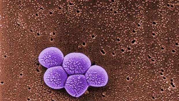 Staphylococcus aureus