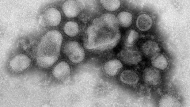 Virus chřipky A/H1N1