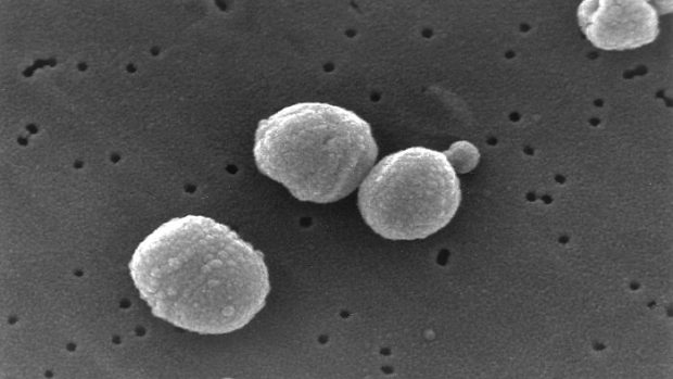 Streptococcus pneumoniae - původce zápalu plic