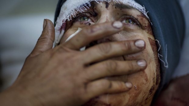 Zraněná žena z města Idlíb. Při zásahu Asadových jednotek na její dům byl zabit její manžel i dvě děti