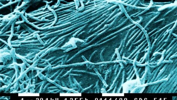 Virus ebola na snímku z elektronového mikroskopu