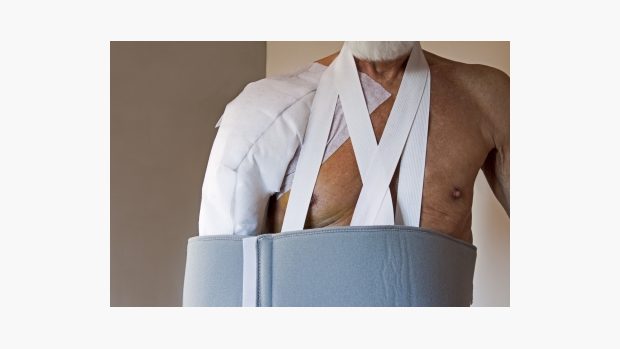 Zraněné rameno (ilustrační foto)