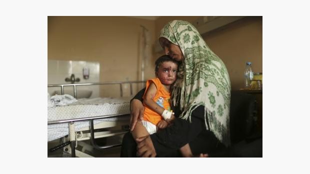 Palestinský chlapec, který byl zraněn v izraelsko-palestinském konfliktu. Ministr Lubomír Zaorálek plánuje v ČR léčbu zraněných dětí z Gazy