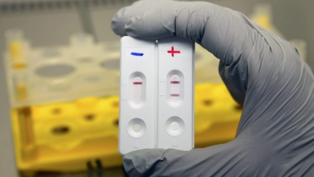 Francouzští vědci zkoušejí nový test na ebolu. Podobá se těhotenskému