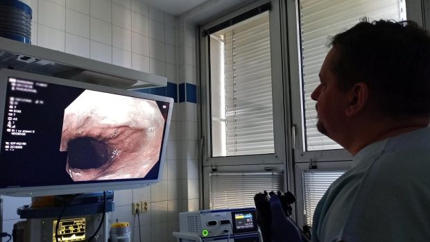 Kdysi lékaři pomocí endoskopu především vyšetřovali, dnes už se tímto optickým přístrojem také operuje