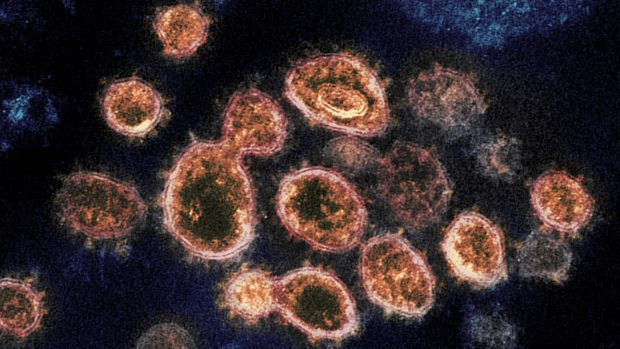 Nový koronavirus: snímek viru SARS-CoV-2, který způsobuje nemoc COVID-19, pod elektronovým mikroskopem. Výběžky na vnějším okraji vytvářejí podobu koróny či koruny, dle čehož se koronaviry označují. Fotografie od amerického úřadu National Institute of Health