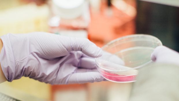 Polští vědci objevili gen, který zdvojnásobuje riziko těžkého průběhu covidu-19