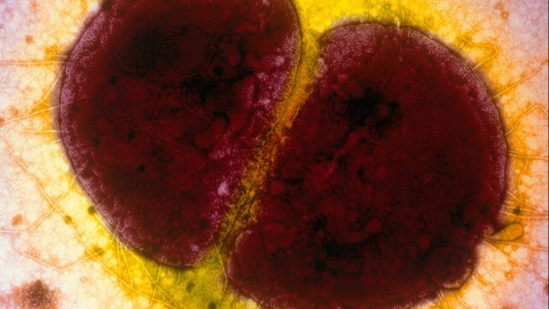 Kapavkou onemocní každý rok kolem 78 milionů lidí. Na snímku bakterie Neisseria gonorrhoea.
