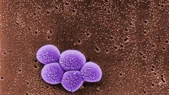 Staphylococcus aureus