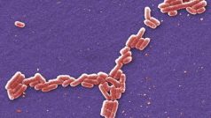 Bakterie Escherichia coli