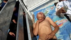 Chlapec zraněný při nepokojích v Kyrgyzstánu
