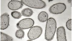 Bakterie Desulfovibrio desulfuricans obklopené nanočásticemi palladia