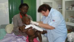 Humanitární pomoc ADRA ČR africké Keni - ošetření popáleného dítěte