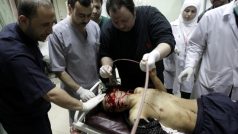 Zraněného muže ošetřují po protivládní demonstraci v Sýrii