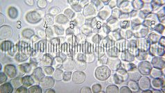 Pekařské kvasinky (Saccharomyces cerevisiae)