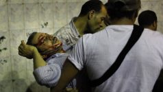 Koptský muž, zraněný při nedělních střetech v Káhiře
