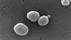 Streptococcus pneumoniae - původce zápalu plic