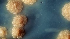 Kultura bakterií Mycobacterium tuberculosis