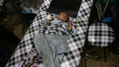 Zraněné dítě v polní nemocnici v Sýrii