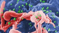 Záběry z elektronového mikroskopu zachycují vir HIV (zeleně)