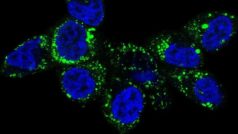 Fragmentace mitochondrií a jejich pohyb směrem k buněčné periferii