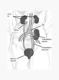 Transplantace