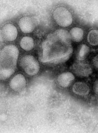 Virus &quot;nové&quot; chřipky H1N1