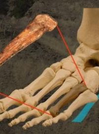 Perfektně zachovalá metatarzální kůstka druhu Australopithecus afarensis, která připojovala prst k bázi chodidla, byla nalezena v etiopském Hadaru