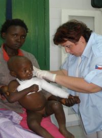 Humanitární pomoc ADRA ČR africké Keni - ošetření popáleného dítěte