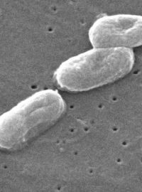 Bakterie Burkholderia cepacia, snímek ze skenovacího elektronového mikroskopu