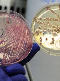 Bakterie EHEC v laboratoři