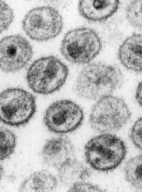 Virus HIV pod elektronovým mikroskopem