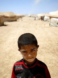 Sedmiletý syrský uprchlík v jordánském táboře