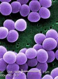 Staphylococcus aureus, zlatý stafylokok, 20,000x zvětšeno pod elektronovým mikroskopem