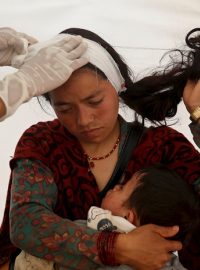 Ošetření nepálské ženy