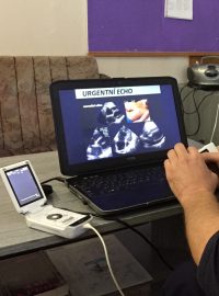 Přenosný ultrazvuk Středočeské záchranky