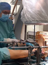 Primář 1. ortopedické kliniky Stanislav Popelka se pouští do totální endoprotézy kotníku