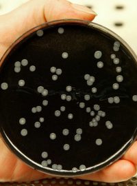 Bakterie legionelly