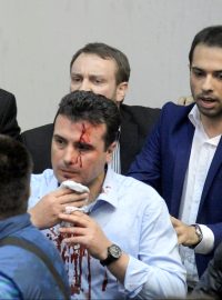 Zraněný lídr sociálních demokratů Zoran Zaev