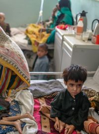 Nemocnice v Afghánistánu se plní podvyživenými dětmi, kterých kvůli krizi neustále přibývá