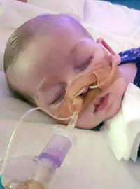 Charlie Gard trpí nevyléčitelným syndromem mitochondriálního vyčerpání. Bez pomoci lékařů nemůže dýchat ani se hýbat, navíc nevidí a neslyší