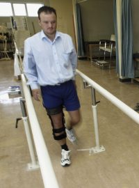 VZP šetří na pacientech s protézou, píše MF Dnes (ilustrační foto)